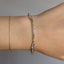 Spritz Bracelet