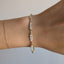 Seltzer Bracelet
